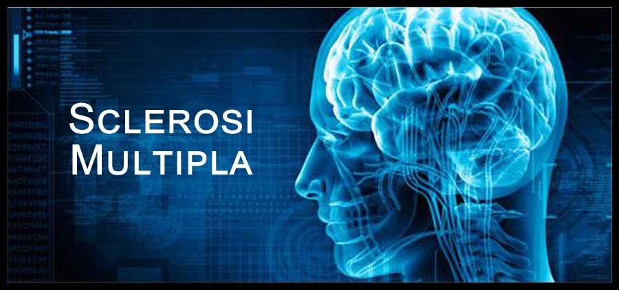 IL MANIFESTO CHE INVITA A PROSEGUIRE L’INDAGINE SUL SISTEMA VENOSO CEREBRALE NELLA SCLEROSI MULTIPLA