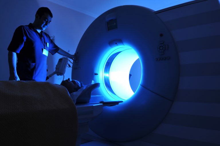 SCLEROSI MULTIPLA: ANOMALIE VENOSE E SVILUPPO LESIONI
