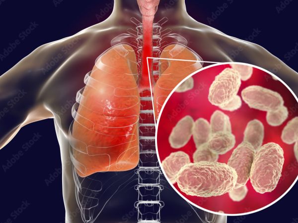 Diagnosi e trattamento della sclerosi multipla e della sclerosi laterale amiotrofica: neuropatie da Bordetella pertussis